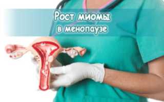 Миома после климакса симптомы