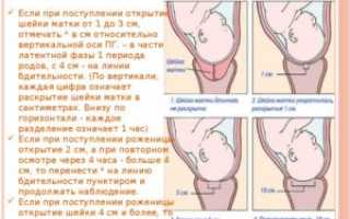 Открыта матка на 1 палец когда роды
