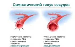Повышен тонус магистральных артерий