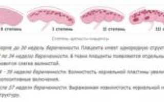 Плацента когда начинает стареть