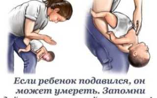Что делать если малыш подавился