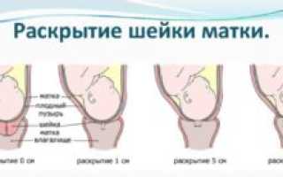 Сколько должно быть открытие шейки матки для родов