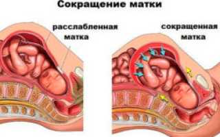 Сокращение матки без беременности