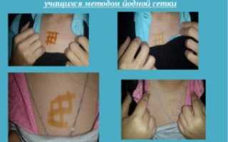 Можно ли делать йодовую сетку на горло беременным
